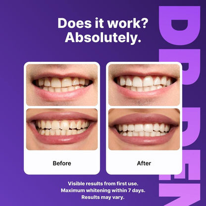 Teeth Whitening Strips